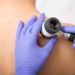 Dr Dupati - Dermoscopy and Skin Cancer Diagnosis - Apollo Dermatology Troy MI Rochester Hills MI