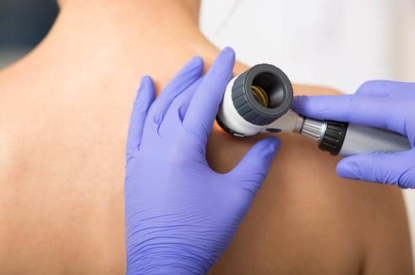 Dermoscopy: See a Board-Certified Dermatologist Trained in Dermoscopy for Skin Cancer Screenings - Rochester Hills Dermatologist Dr. Arjun Dupati