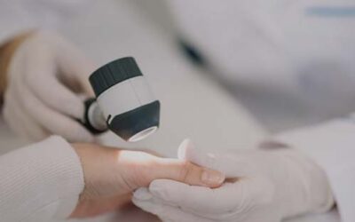 Apollo Dermatology: Expanding Skin Cancer Care in Rochester Hills, MI While Providing Expert Cosmetic Services