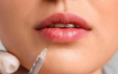 Lip Filler Treatments: Why Precision and Expert Skill Matter Most
