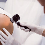 Expert Skin Cancer Screenings at Apollo Dermatology Rochester Hills MI