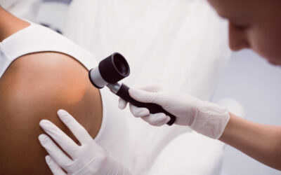 Expert Skin Cancer Screenings at Apollo Dermatology in Rochester Hills