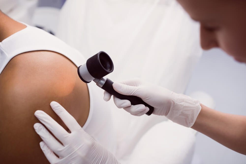 Expert Skin Cancer Screenings at Apollo Dermatology Rochester Hills MI