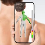 SkinMap - Advanced Total Body Photography at Apollo Dermatology in Rochester Hills and Troy MI