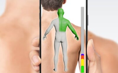 Introducing SkinMap: Advanced Total Body Photography at Apollo Dermatology